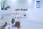 بلیچینگ دندان؛ روشی مطمئن برای سفید کردن دندان
