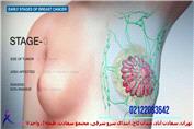 فیلم عمل جراحی سرطان سینه