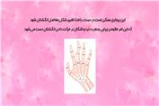 روماتیسم مفصلی یا آرتریت روماتوئید