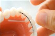 نخ دندان سوپر فلاس | دکتر محمد محمدی